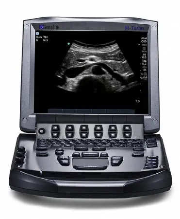 Soma Technology - Sonosite M - Turbo - SON-002 - Refurbished Ultrasound System Sonosite M - Turbo With Probe, Up To 165 Db Dynamic Range, 256 Shades Grey Scale, Audio Output, Integrated Speakers, Lithium-ion Battery, Mpeg-4 (h.264), Jpeg, Bmp, Html Usb St