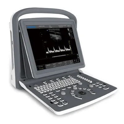 Imaging Associates - Chison - CHISON ECO2 - Ultrasound System Chison 256 Levels Scale, 240 Mm Max Depth Scanning, 3 Usb Ports, 1 Probe Connectors, 8 Gb Memory Card, Pw Mode