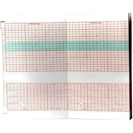 Cooper Surgical - Edan - M25R-75111 - Fetal Diagnostic Monitor Recording Paper Edan Thermal Paper 90 mm X 152 mm Roll Red Grid