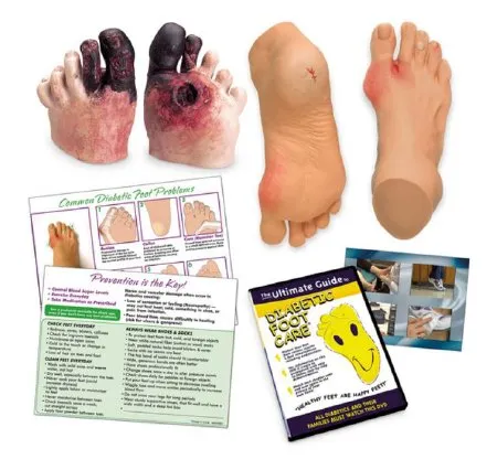 Nasco - Life/form / TearPad - WA29842 - Diabetic Foot Care Education Life/form / TearPad