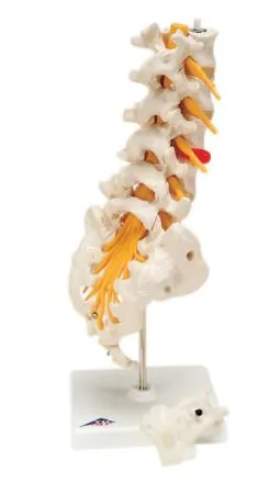 Fabrication Enterprises - 12-4543 - 3b Scientific Anatomical Model - Lumbar Spinal Column With Dorso-lateral Prolapsed Disc - Includes 3b Smart Anatomy
