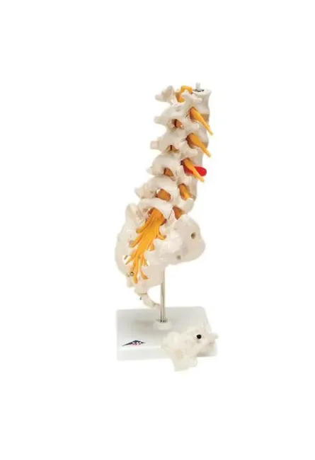 Fabrication Enterprises - 12-4543 - 3b Scientific Anatomical Model - Lumbar Spinal Column With Dorso-lateral Prolapsed Disc - Includes 3b Smart Anatomy