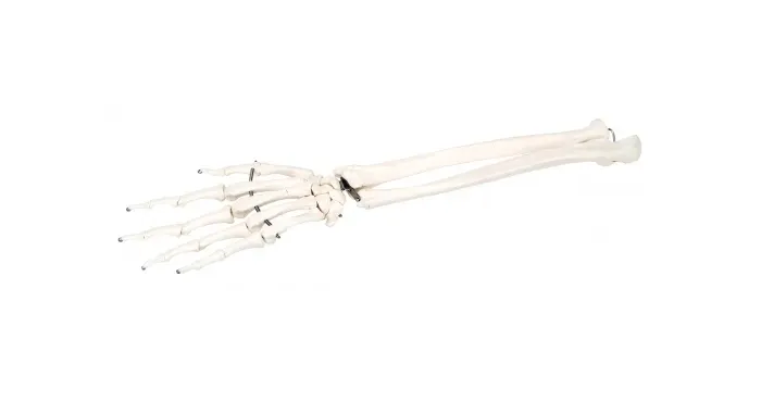 Fabrication Enterprises - 12-4581R - Anatomical Model - loose bones, hand skeleton with ulna and radius, right (wire)