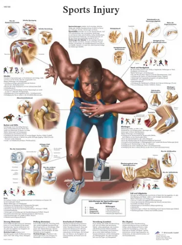 Fabrication Enterprises - From: 12-4623L To: 12-4623S - Anatomical Chart sports injuries, laminated