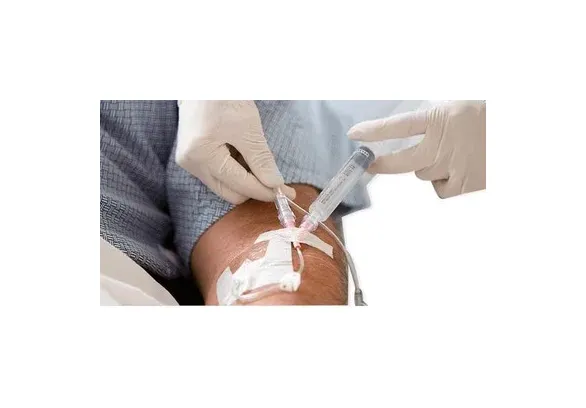 BD Becton Dickinson - 383592 - Nexiva Diffusics Closed IV Catheter Nexiva Diffusics 20 Gauge 1 Inch Without Safety