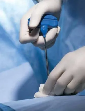 Bd Becton Dickinson - Safe-T Plus - Bctm3411sp - Biopsy Tray Safe-T Plus Bone Marrow T-Handle Jamshidi Needle / Marrow Acquisition Cradle