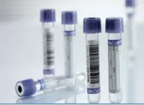 Greiner Bio-One - Vacuette - 454217 -  VACUETTE Venous Blood Collection Tube K3 EDTA Additive 3 mL Pull Cap Polyethylene Terephthalate (PET) Tube