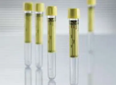 Greiner Bio-One - 455028 - Greiner Vacuette Z Urine No Additive Urinalysis Tube