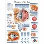 American 3B Scientific From: VR1231L To: VR1231UU - Diseases Of The Eye Chart_EN_L Chart_EN_P