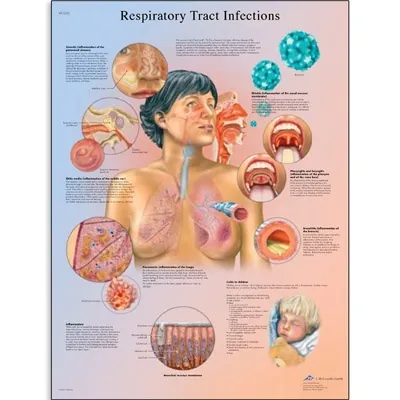 American 3B Scientific - From: VR1253L To: VR1253UU - Respiratory Tract Infections Chart_EN_L