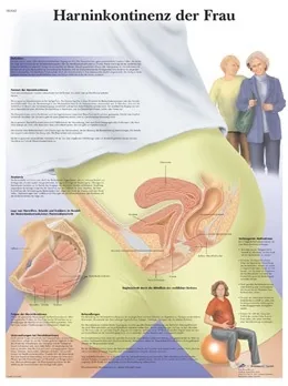 American 3B Scientific - From: VR2542L To: VR2542UU - Incontinence urinaire Femme Chart_FR_L
