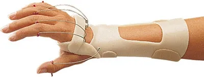 Fabrication Enterprises - Orfit - From: 24-5921 To: 24-5927 -  Radial Wrist Extension Splint