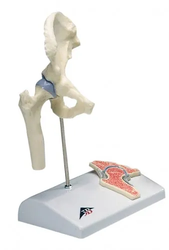 Fabrication Enterprises From: 12-4517 To: 12-4520 - Anatomical Model - Mini Hip Joint With Cross Section Of Bone On Base Knee Model: Shoulder W/cross El