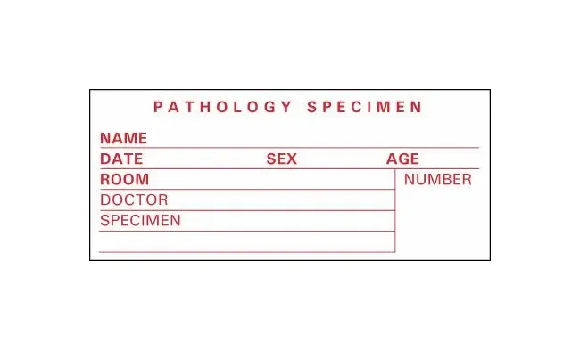 Precision Dynamics - Timemed - Sp-4 - Pre-Printed Label Timemed Laboratory Use White Pathology Specimen, Name, Date, Sex, Age, Room, Doctor, Speciment, Number Red Lab / Specimen 1-1/2 X 3-1/2 Inch