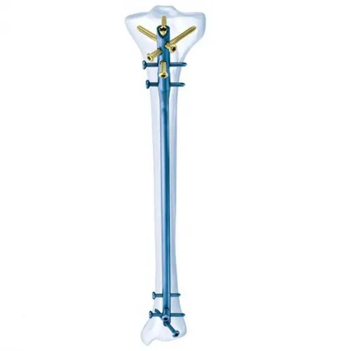 Synthes - 04.004.761S - SYNTHES 13MM TI CANNULATED TIBIAL NAIL EEX/405MM